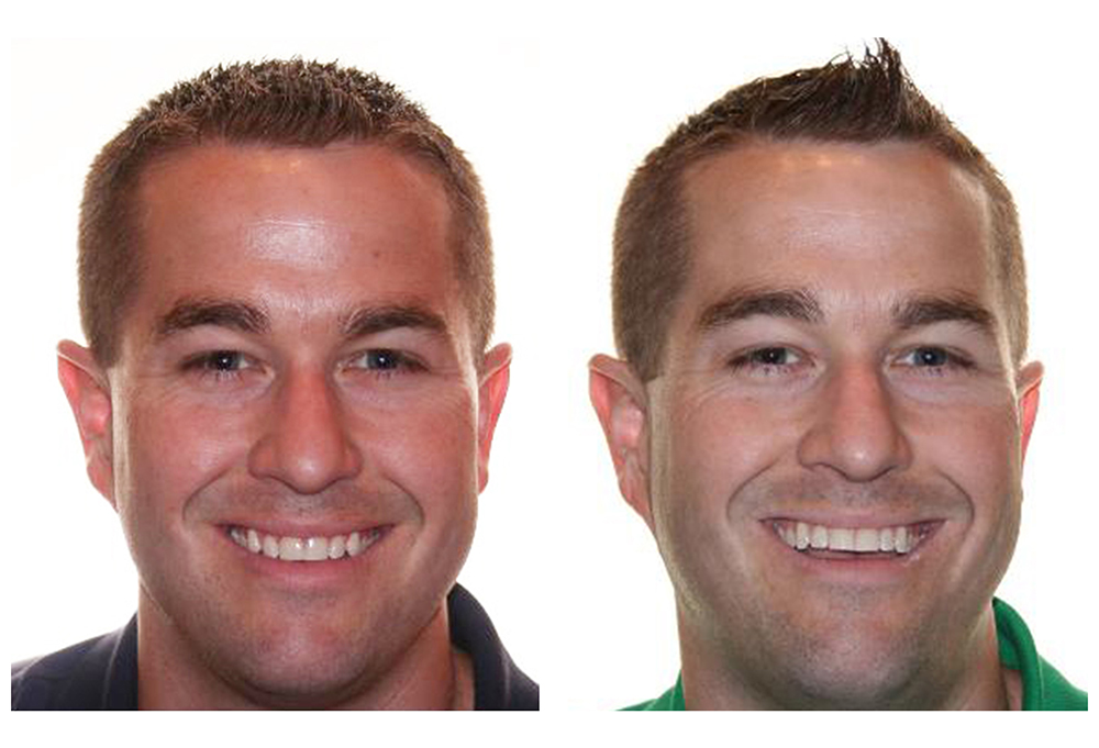 Towne Dental   Orthodontics