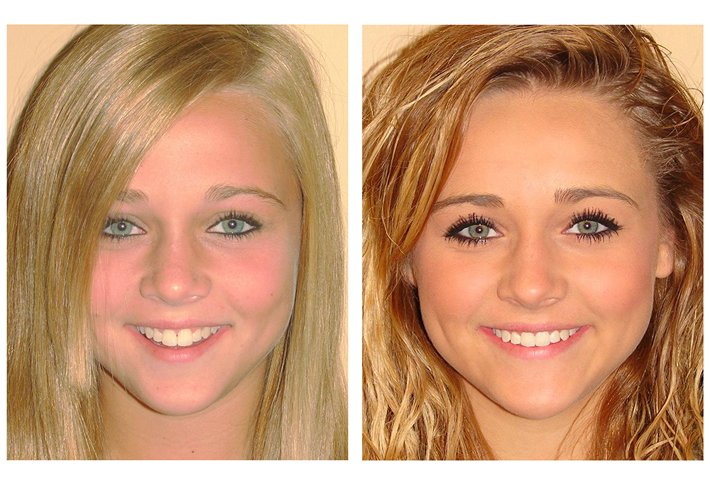 Towne Dental   Orthodontics