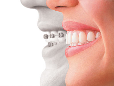 The image features a split photograph showing a person s face on one side with a wide smile and teeth, while the other side shows a dental implant being placed by a surgeon.