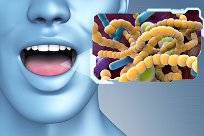 The image depicts a person with an open mouth, holding a card with a microscopic view of bacteria, emphasizing the importance of oral hygiene.