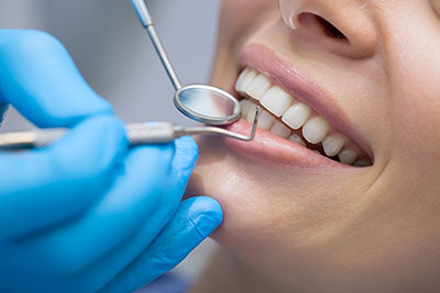 The image depicts a dental professional performing oral care on a patient s teeth while wearing a blue surgical gown and gloves, with the patient smiling broadly during the procedure.