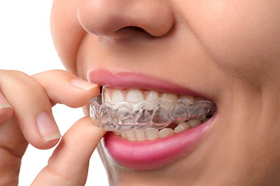 The image shows a person with braces, smiling at the camera.