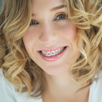 A smiling woman with braces showcasing her teeth.
