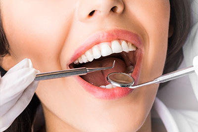 Woman with open mouth receiving dental care, surrounded by dental equipment and staff.