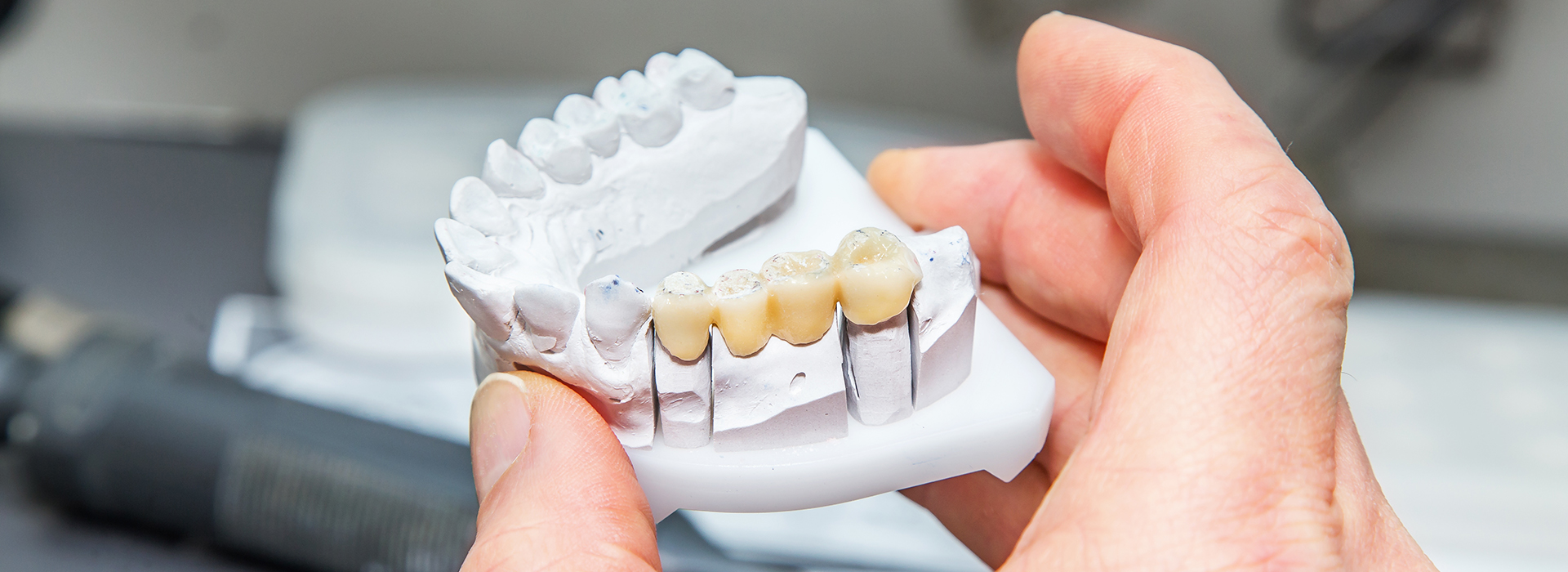 The image shows a person holding up a set of dentures with teeth missing, possibly examining them for repair or replacement.