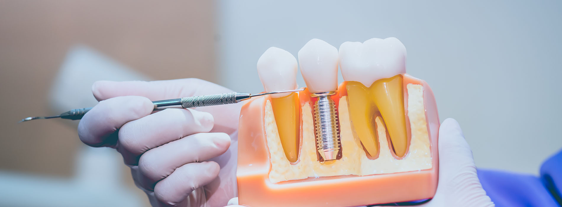 The image shows a dental procedure being performed with a focus on a tooth model in a tray, where a dentist s hand is visible holding a tool near the teeth.