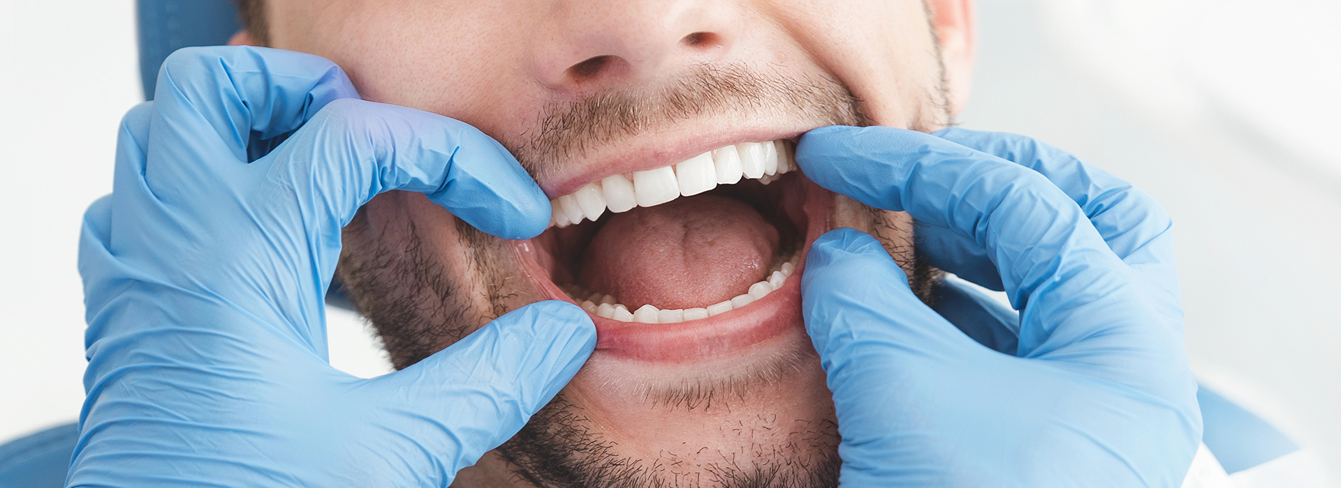 The image shows a man with his mouth open wide, wearing blue gloves and holding his chin with his hands, possibly indicating oral care or dental work.