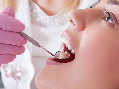 A woman receiving dental care with a dental hygienist performing the procedure, using a mirror to examine her teeth.