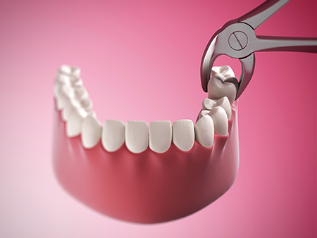 The image depicts a close-up view of dental tools, including pliers, being used on a set of teeth with visible gaps and decay, suggesting a process of dental repair or extraction.