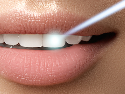 The image shows a close-up of a person s lips with a smile, featuring a bright blue object resembling a toothbrush near their teeth.